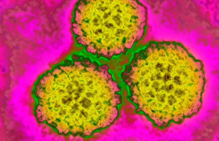 About 1 in 8 cancer cases worldwide are tied to these infections – most of them preventable